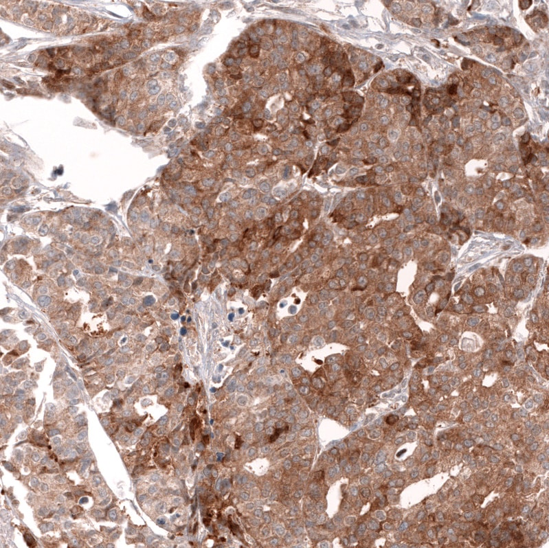 Lgr5/GPR49 Antibody (CL13567) - Azide and BSA Free Immunohistochemistry-Paraffin: Lgr5/GPR49 Antibody [NBP3-43844]