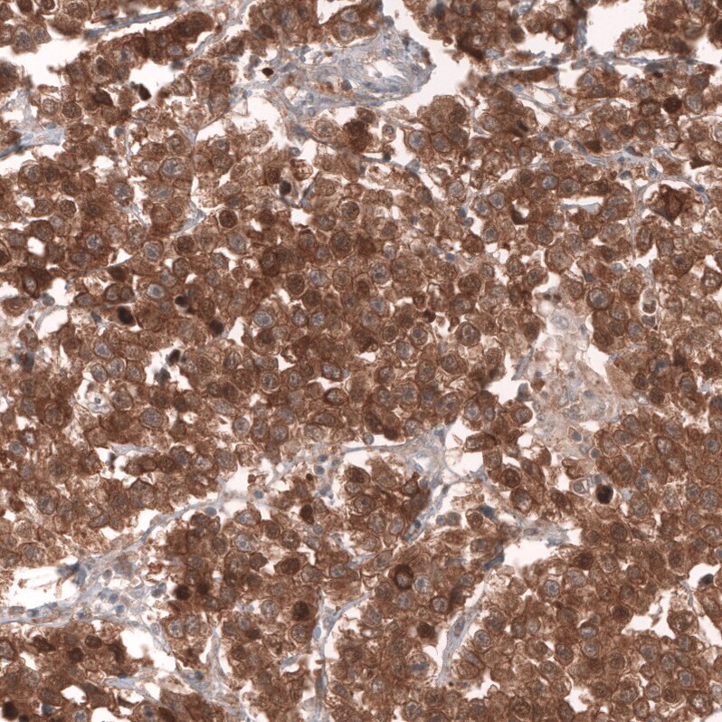 Lgr5/GPR49 Antibody (CL13567) - Azide and BSA Free Immunohistochemistry-Paraffin: Lgr5/GPR49 Antibody [NBP3-43844]
