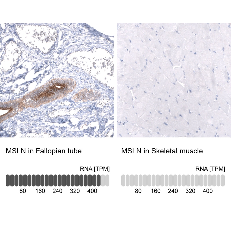 Mesothelin Antibody (CL13956) - Azide and BSA Free Immunohistochemistry-Paraffin: Mesothelin Antibody [NBP3-43845]