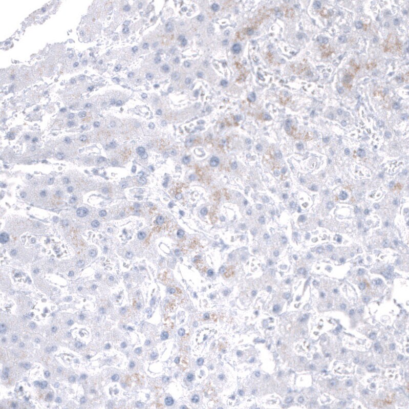 Mesothelin Antibody (CL13956) - Azide and BSA Free Immunohistochemistry-Paraffin: Mesothelin Antibody [NBP3-43845]
