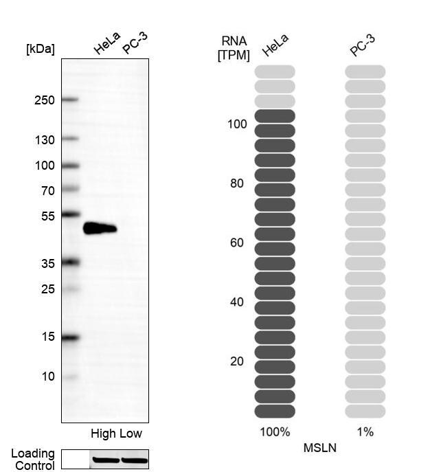 Mesothelin Antibody (CL13956) - Azide and BSA Free Western Blot: Mesothelin Antibody [NBP3-43845]