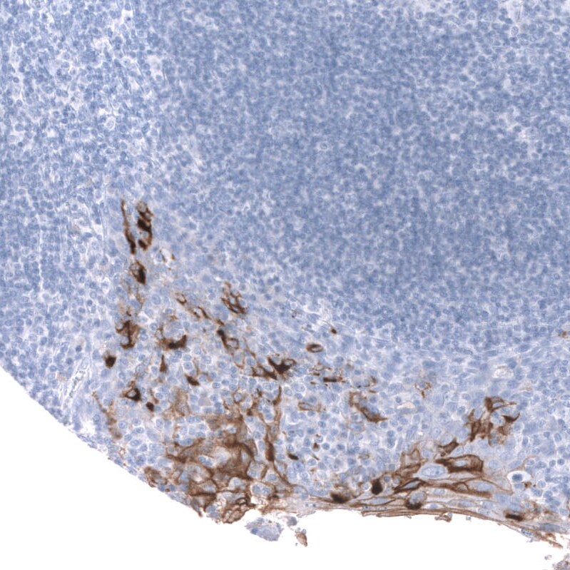 Mesothelin Antibody (CL13956) - Azide and BSA Free Immunohistochemistry-Paraffin: Mesothelin Antibody [NBP3-43845]