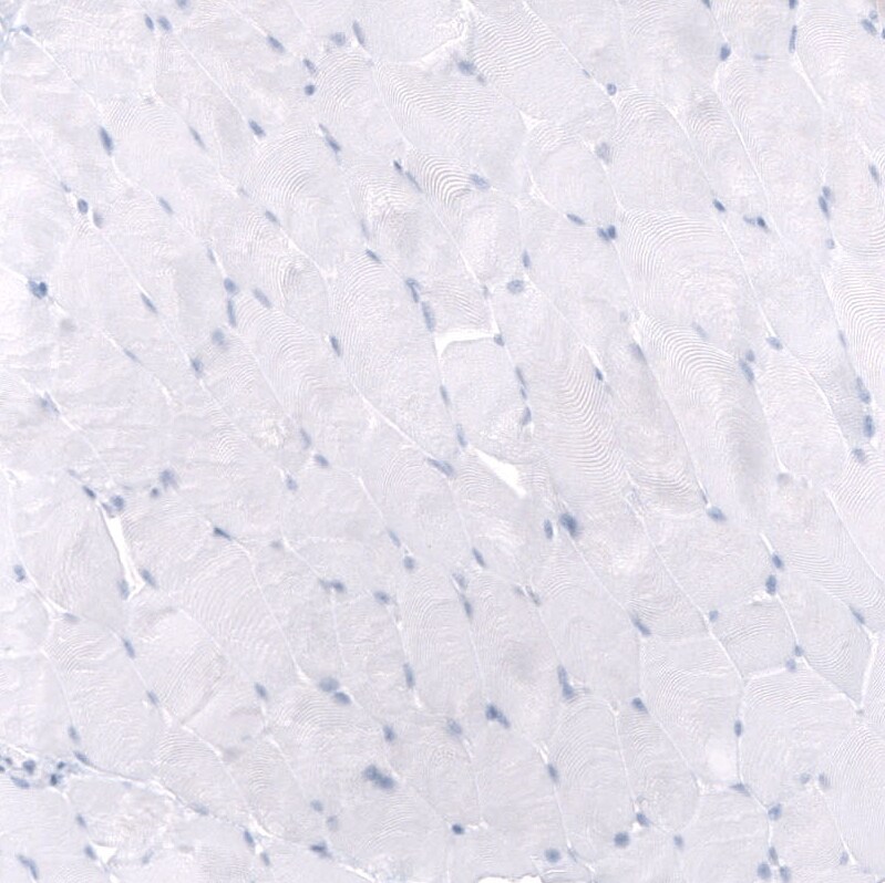 Mesothelin Antibody (CL13956) - Azide and BSA Free Immunohistochemistry-Paraffin: Mesothelin Antibody [NBP3-43845]