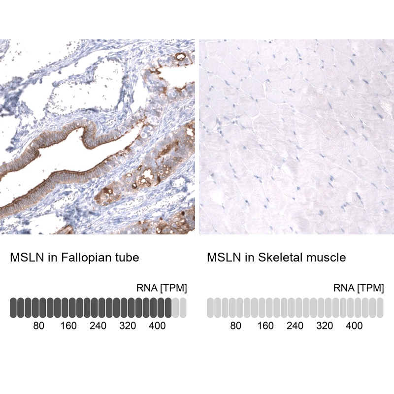 Mesothelin Antibody (CL13957) - Azide and BSA Free Immunohistochemistry-Paraffin: Mesothelin Antibody [NBP3-43846]