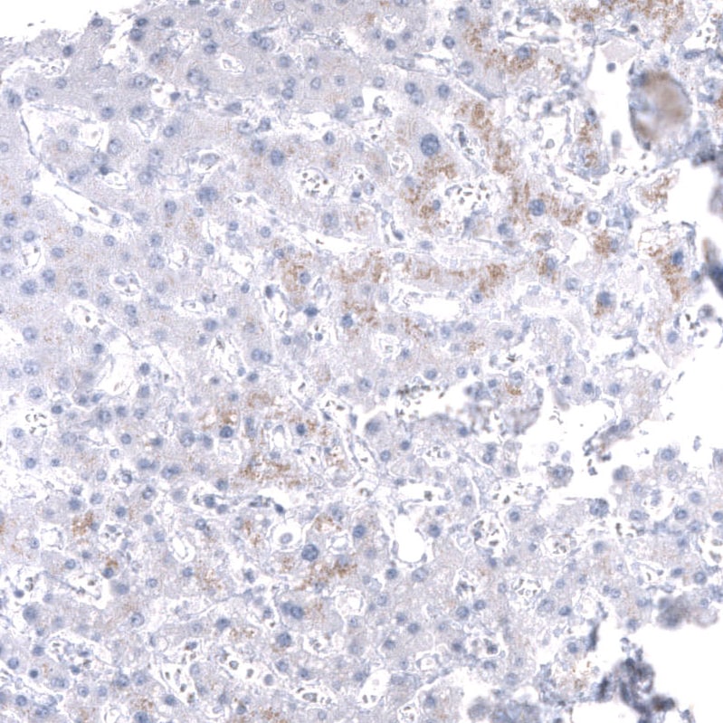 Mesothelin Antibody (CL13957) - Azide and BSA Free Immunohistochemistry-Paraffin: Mesothelin Antibody [NBP3-43846]