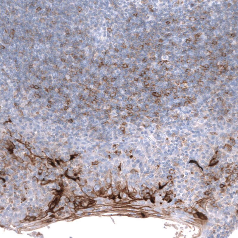 Mesothelin Antibody (CL13957) - Azide and BSA Free Immunohistochemistry-Paraffin: Mesothelin Antibody [NBP3-43846]