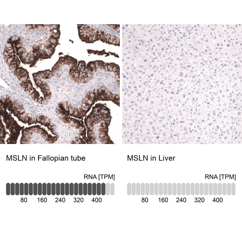 Mesothelin Antibody (CL13965) - Azide and BSA Free Immunohistochemistry-Paraffin: Mesothelin Antibody [NBP3-43848]