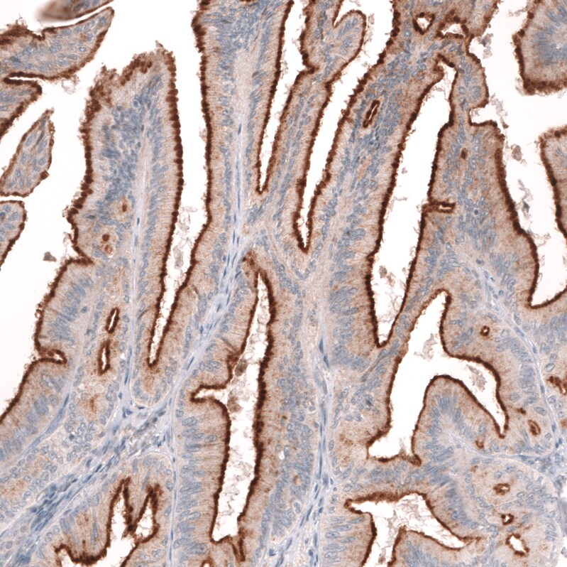Mesothelin Antibody (CL13965) - Azide and BSA Free Immunohistochemistry-Paraffin: Mesothelin Antibody [NBP3-43848]