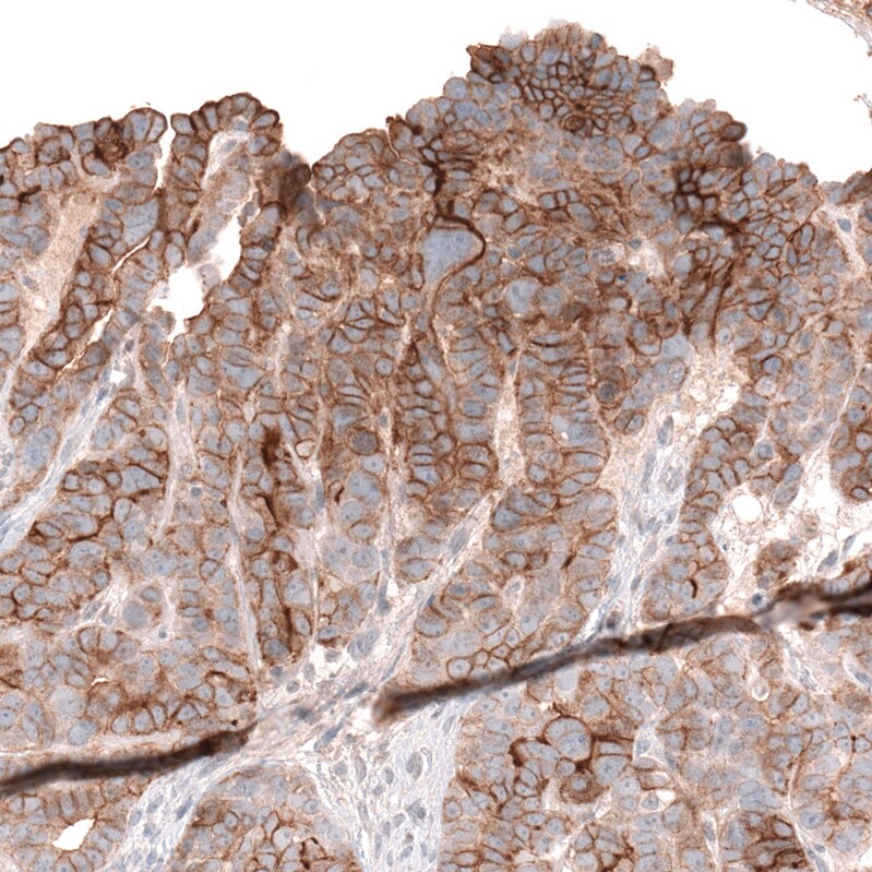 Mesothelin Antibody (CL13965) - Azide and BSA Free Immunohistochemistry-Paraffin: Mesothelin Antibody [NBP3-43848]