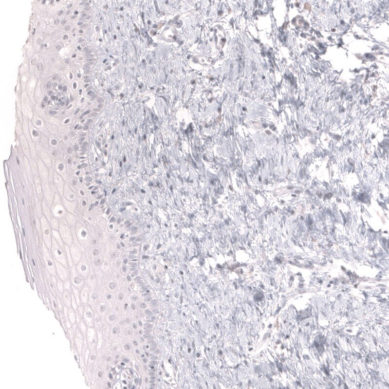 Mesothelin Antibody (CL13965) - Azide and BSA Free Immunohistochemistry-Paraffin: Mesothelin Antibody [NBP3-43848]