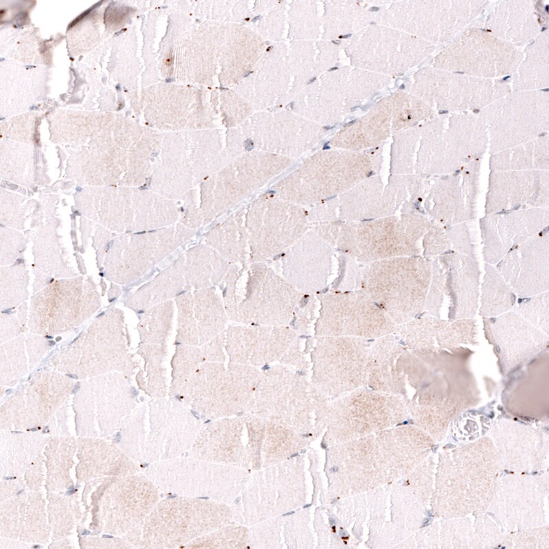MLH3 Antibody (CL14084) - Azide and BSA Free Immunohistochemistry-Paraffin: MLH3 Antibody [NBP3-43849]
