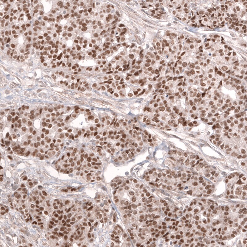 MLH3 Antibody (CL14084) - Azide and BSA Free Immunohistochemistry-Paraffin: MLH3 Antibody [NBP3-43849]