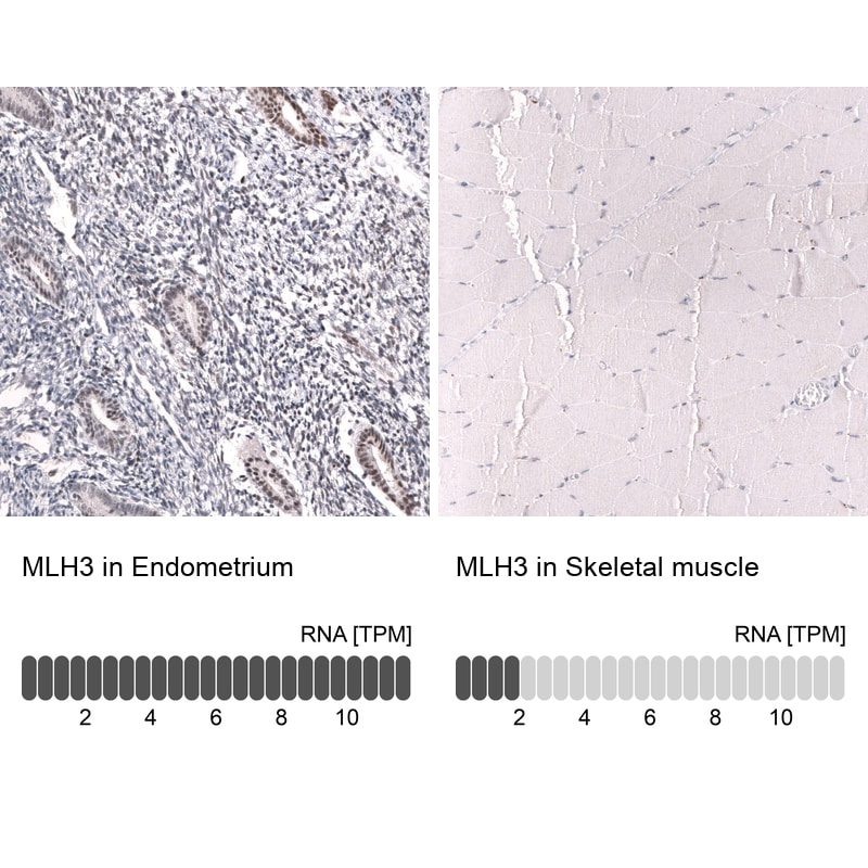 MLH3 Antibody (CL14096) - Azide and BSA Free Immunohistochemistry-Paraffin: MLH3 Antibody [NBP3-43850]