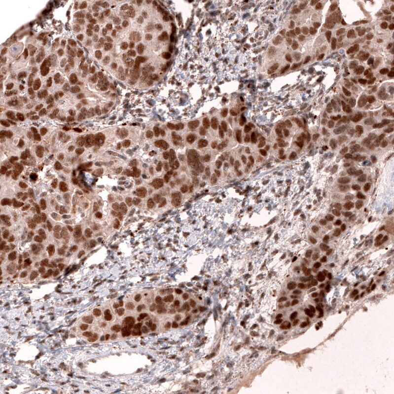 MLH3 Antibody (CL14096) - Azide and BSA Free Immunohistochemistry-Paraffin: MLH3 Antibody [NBP3-43850]