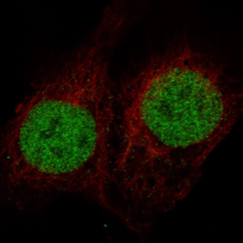 MSH2 Antibody (CL13713) - Azide and BSA Free Immunocytochemistry/ Immunofluorescence: MSH2 Antibody [NBP3-43851]