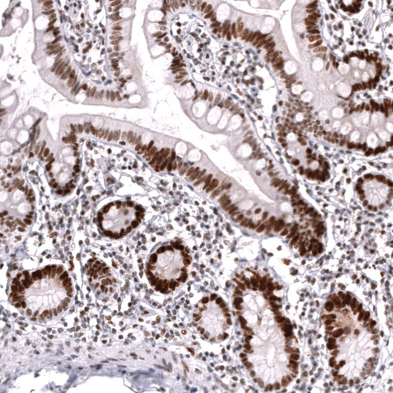 MSH2 Antibody (CL13713) - Azide and BSA Free Immunohistochemistry-Paraffin: MSH2 Antibody [NBP3-43851]