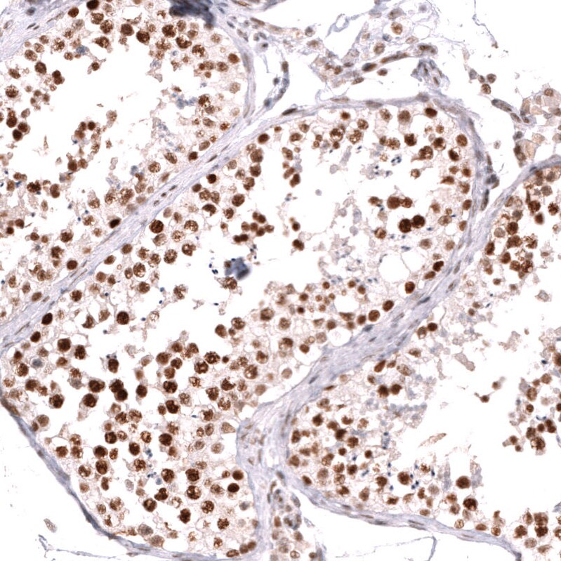 MSH2 Antibody (CL13713) - Azide and BSA Free Immunohistochemistry-Paraffin: MSH2 Antibody [NBP3-43851]