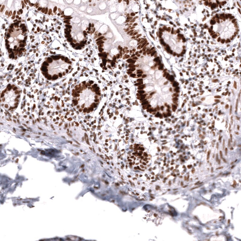 MSH2 Antibody (CL13724) - Azide and BSA Free Immunohistochemistry-Paraffin: MSH2 Antibody [NBP3-43852]