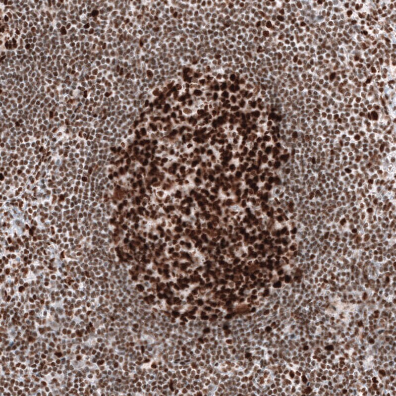 MSH2 Antibody (CL13724) - Azide and BSA Free Immunohistochemistry-Paraffin: MSH2 Antibody [NBP3-43852]