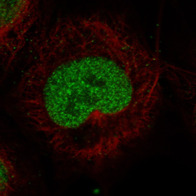 MSH2 Antibody (CL13764) - Azide and BSA Free Immunocytochemistry/ Immunofluorescence: MSH2 Antibody [NBP3-43853]