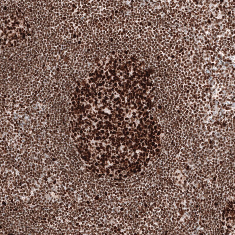 MSH2 Antibody (CL13764) - Azide and BSA Free Immunohistochemistry-Paraffin: MSH2 Antibody [NBP3-43853]