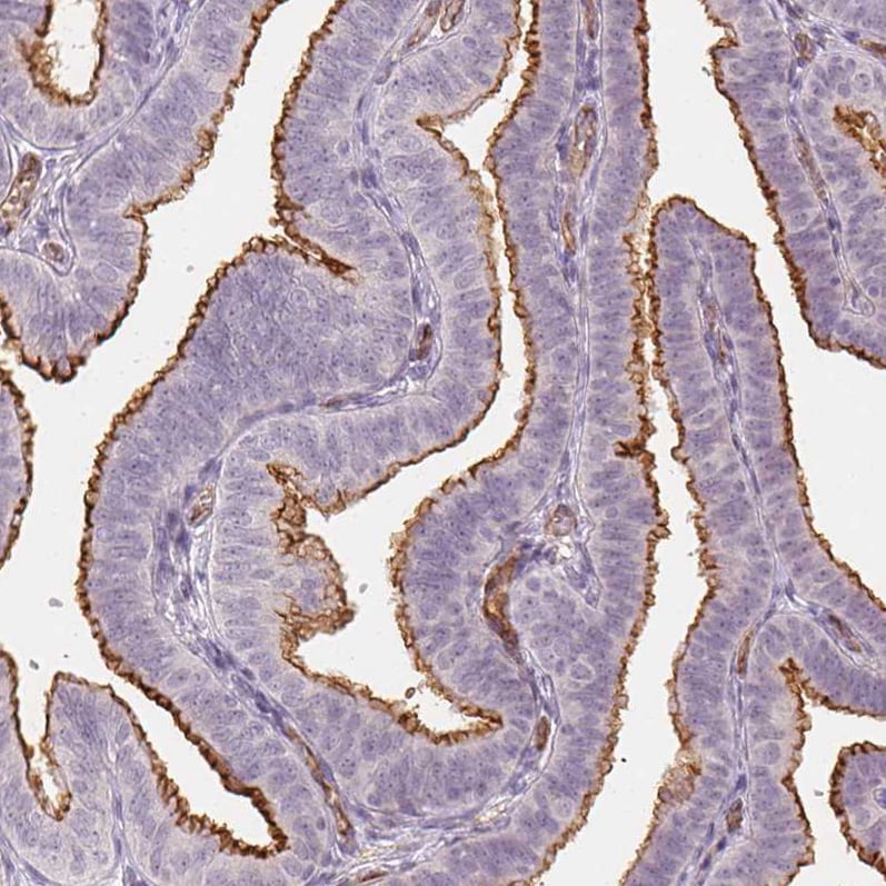 Podocalyxin Like Antibody (CL0285) - Azide and BSA Free Immunohistochemistry-Paraffin: Podocalyxin Like Antibody [NBP3-43854]