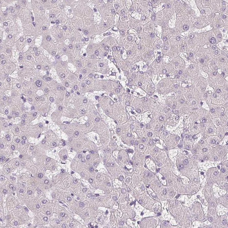 Podocalyxin Like Antibody (CL0285) - Azide and BSA Free Immunohistochemistry-Paraffin: Podocalyxin Like Antibody [NBP3-43854]