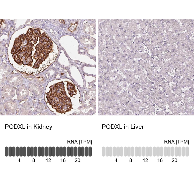 Podocalyxin Like Antibody (CL0285) - Azide and BSA Free Immunohistochemistry-Paraffin: Podocalyxin Like Antibody [NBP3-43854]