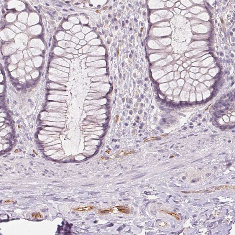 Podocalyxin Like Antibody (CL0285) - Azide and BSA Free Immunohistochemistry-Paraffin: Podocalyxin Like Antibody [NBP3-43854]