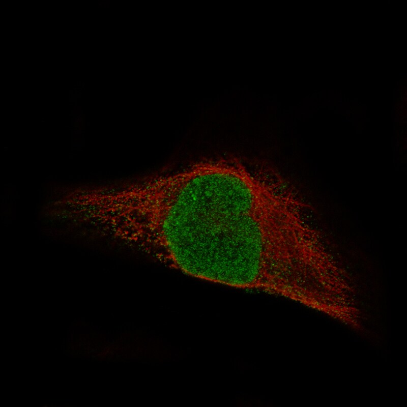 MSH3 Antibody (CL14059) - Azide and BSA Free Immunocytochemistry/ Immunofluorescence: MSH3 Antibody [NBP3-43855]