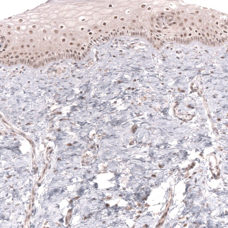 MSH3 Antibody (CL14059) - Azide and BSA Free Immunohistochemistry-Paraffin: MSH3 Antibody [NBP3-43855]