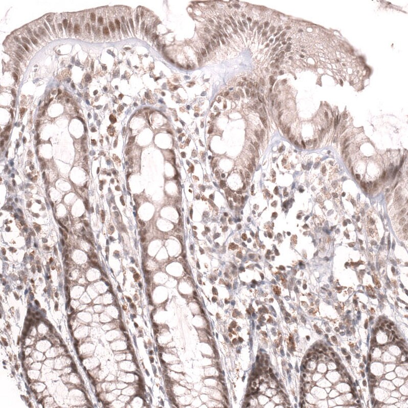 MSH3 Antibody (CL14059) - Azide and BSA Free Immunohistochemistry-Paraffin: MSH3 Antibody [NBP3-43855]