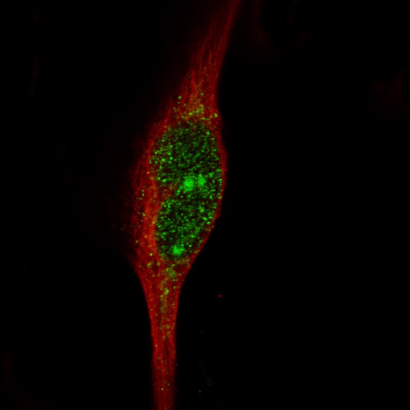 MSH3 Antibody (CL14064) - Azide and BSA Free Immunocytochemistry/ Immunofluorescence: MSH3 Antibody [NBP3-43856]