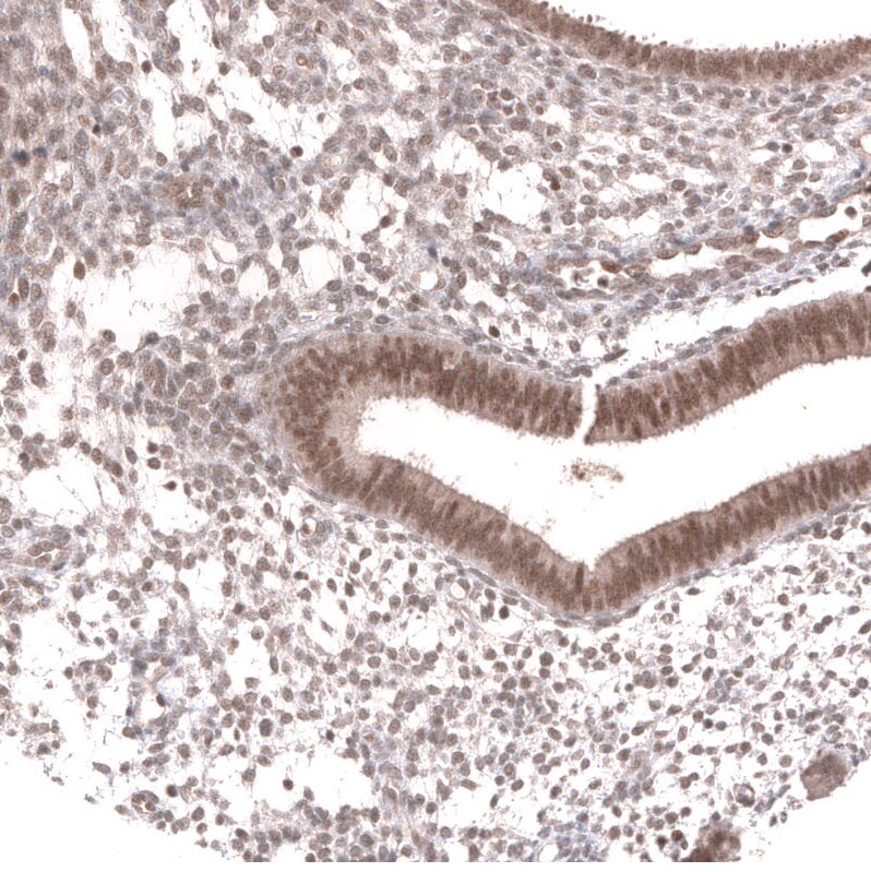 MSH3 Antibody (CL14064) - Azide and BSA Free Immunohistochemistry-Paraffin: MSH3 Antibody [NBP3-43856]