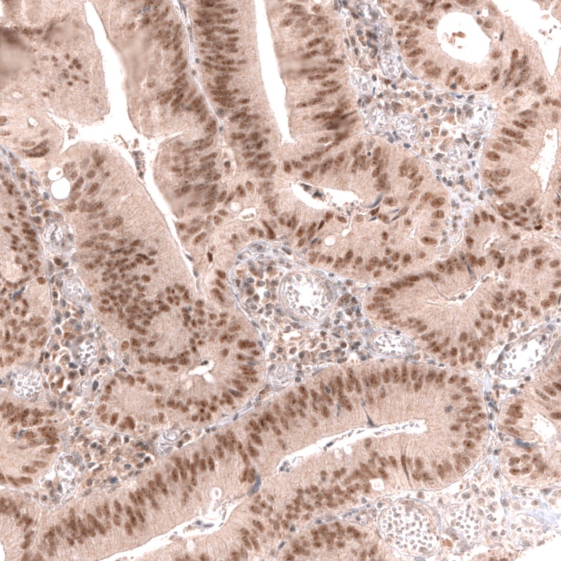 MSH3 Antibody (CL14064) - Azide and BSA Free Immunohistochemistry-Paraffin: MSH3 Antibody [NBP3-43856]