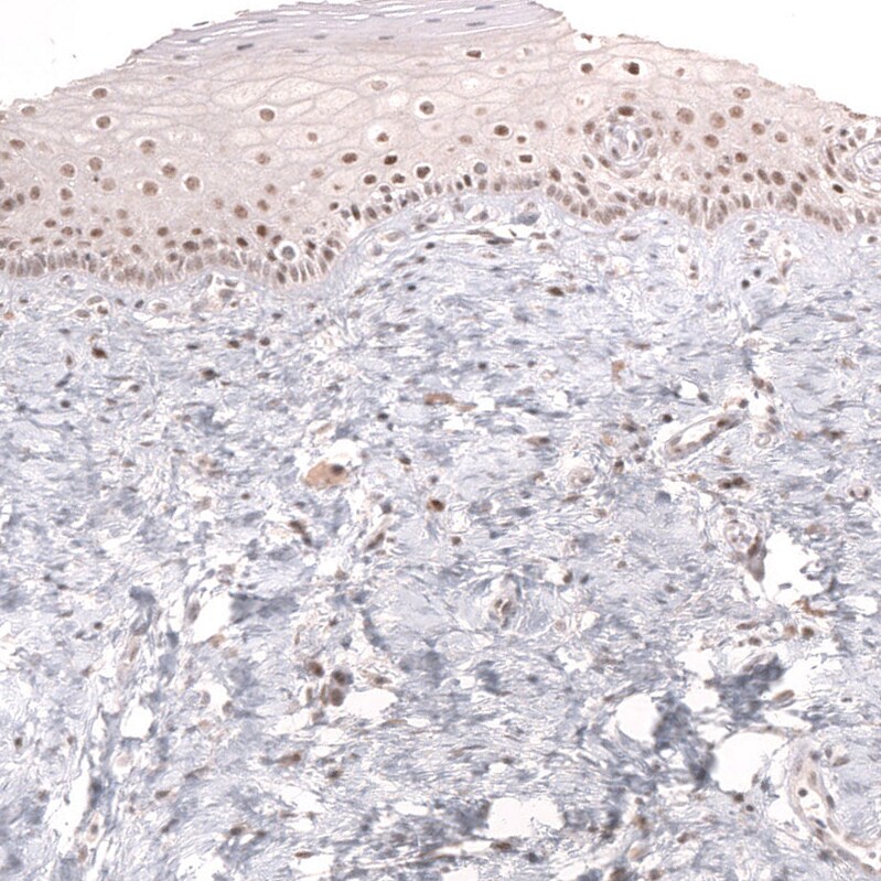MSH3 Antibody (CL14064) - Azide and BSA Free Immunohistochemistry-Paraffin: MSH3 Antibody [NBP3-43856]
