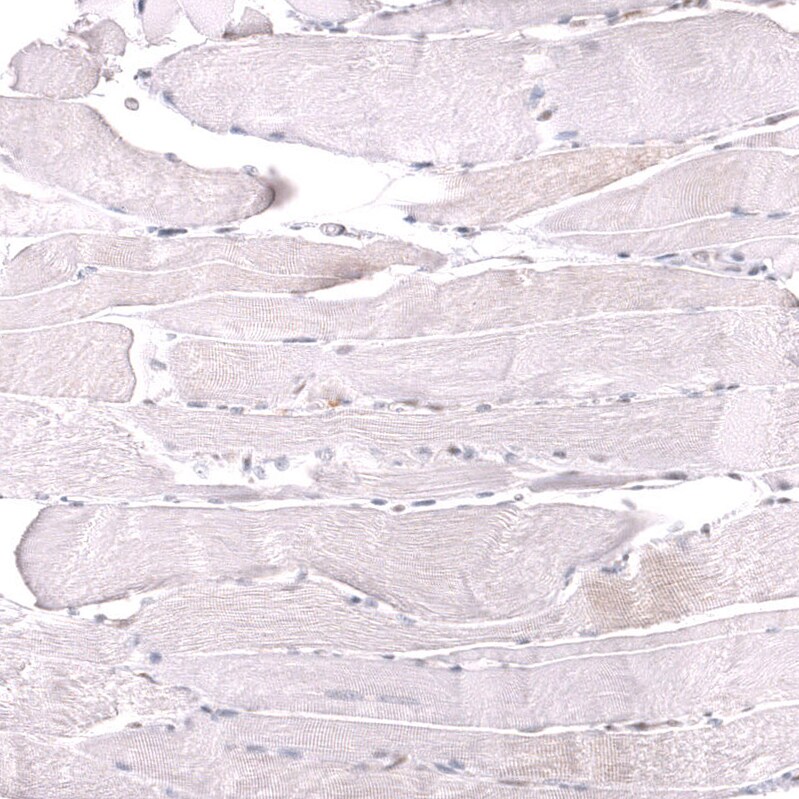 MSH6 Antibody (CL13844) - Azide and BSA Free Immunohistochemistry-Paraffin: MSH6 Antibody [NBP3-43857]