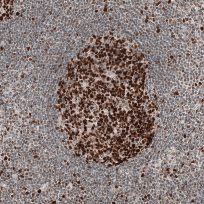 MSH6 Antibody (CL13844) - Azide and BSA Free Immunohistochemistry-Paraffin: MSH6 Antibody [NBP3-43857]
