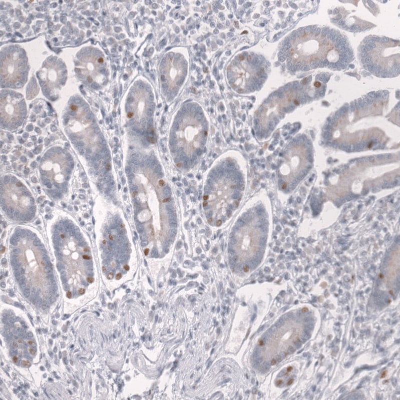 Prox1 Antibody (CL13472) - Azide and BSA Free Immunohistochemistry-Paraffin: Prox1 Antibody [NBP3-43858]