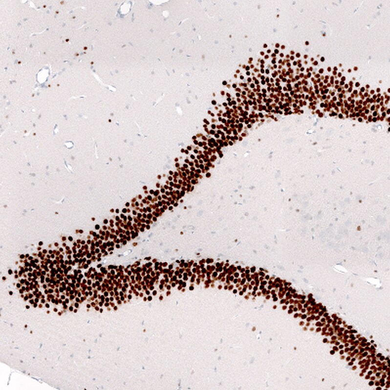 Prox1 Antibody (CL13472) - Azide and BSA Free Immunohistochemistry-Paraffin: Prox1 Antibody [NBP3-43858]