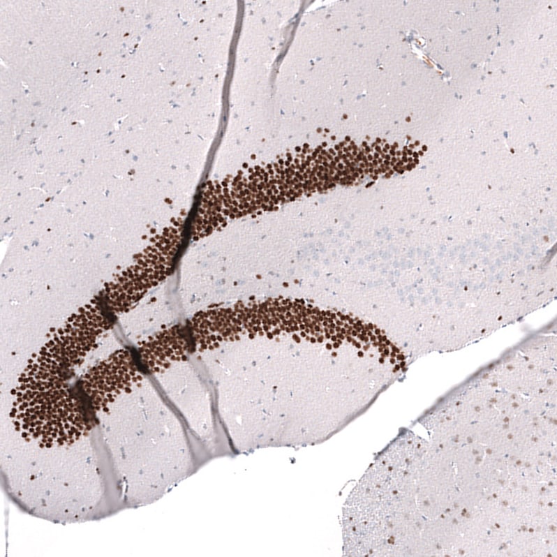 Prox1 Antibody (CL13472) - Azide and BSA Free Immunohistochemistry-Paraffin: Prox1 Antibody [NBP3-43858]