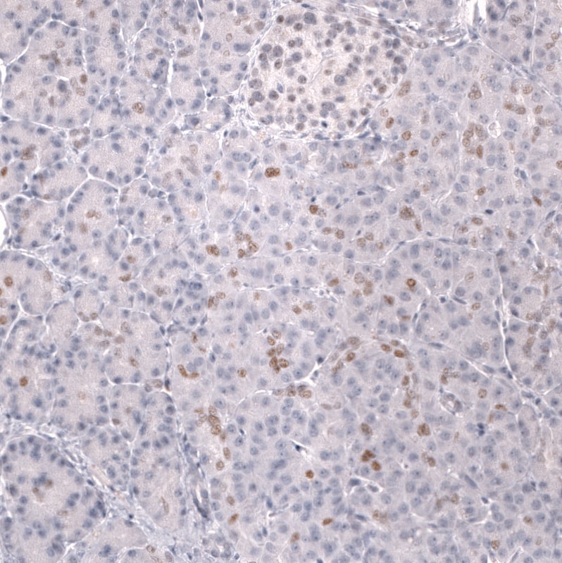 Prox1 Antibody (CL13472) - Azide and BSA Free Immunohistochemistry-Paraffin: Prox1 Antibody [NBP3-43858]