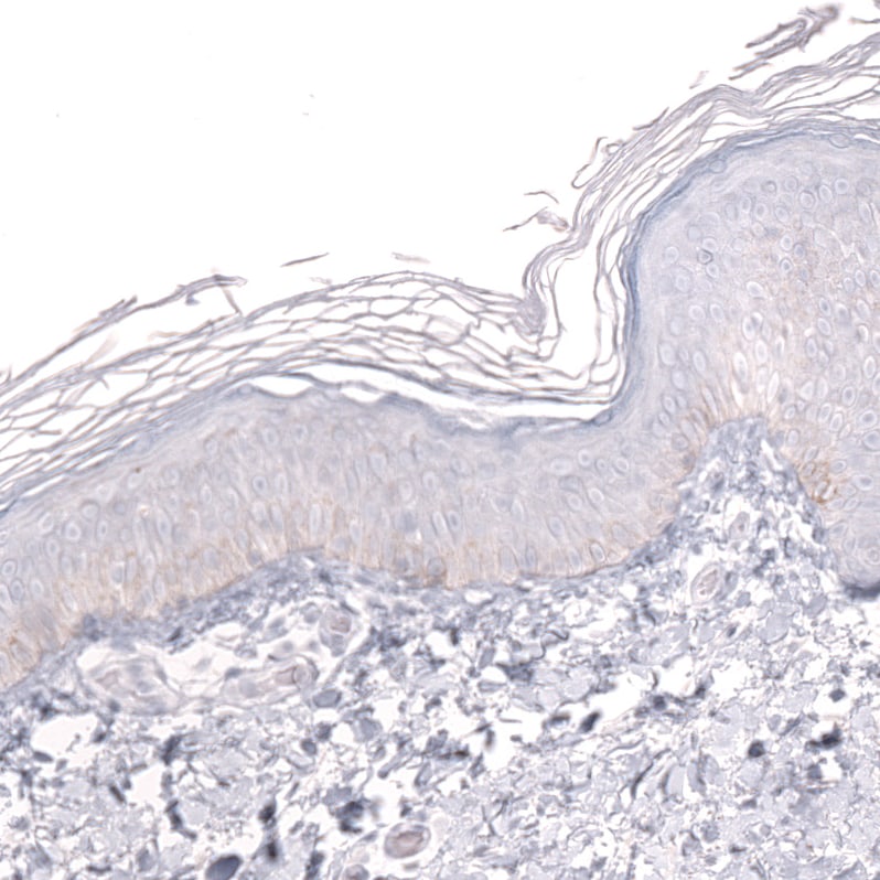 Prox1 Antibody (CL13472) - Azide and BSA Free Immunohistochemistry-Paraffin: Prox1 Antibody [NBP3-43858]