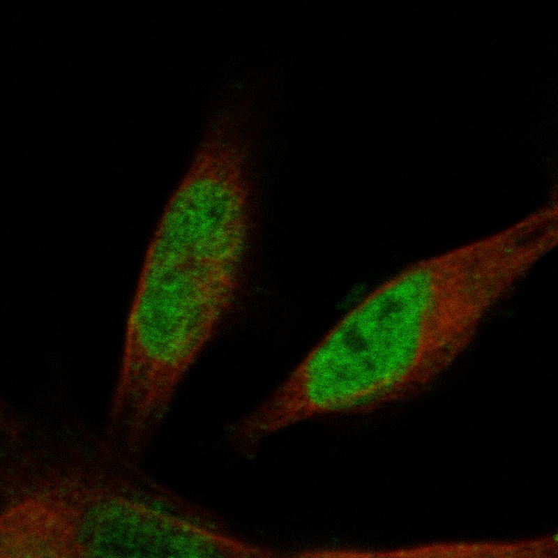 Prox1 Antibody (CL13474) - Azide and BSA Free Immunocytochemistry/ Immunofluorescence: Prox1 Antibody [NBP3-43859]