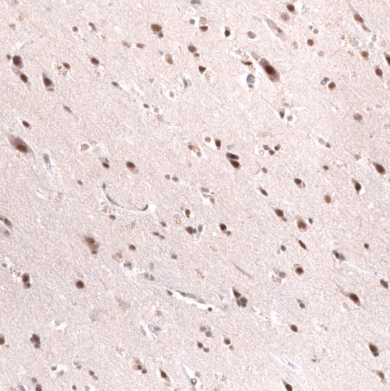 SNF5 Antibody (CL13973) - Azide and BSA Free Immunohistochemistry-Paraffin: SNF5 Antibody [NBP3-43860]
