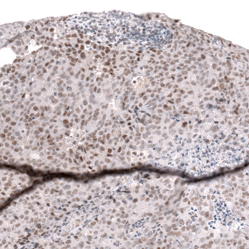 SNF5 Antibody (CL13973) - Azide and BSA Free Immunohistochemistry-Paraffin: SNF5 Antibody [NBP3-43860]