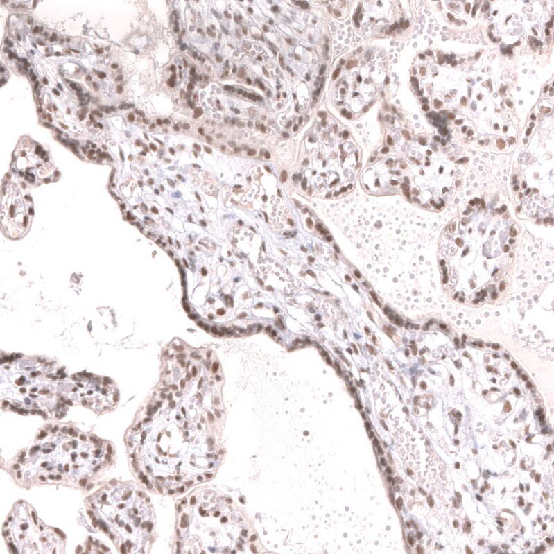 SNF5 Antibody (CL13973) - Azide and BSA Free Immunohistochemistry-Paraffin: SNF5 Antibody [NBP3-43860]