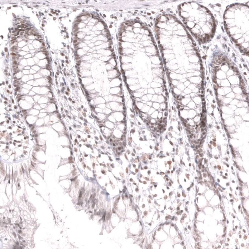 SNF5 Antibody (CL13973) - Azide and BSA Free Immunohistochemistry-Paraffin: SNF5 Antibody [NBP3-43860]