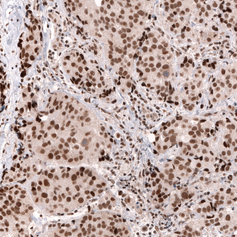 SNF5 Antibody (CL13992) - Azide and BSA Free Immunohistochemistry-Paraffin: SNF5 Antibody [NBP3-43862]