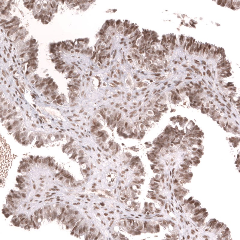SNF5 Antibody (CL13992) - Azide and BSA Free Immunohistochemistry-Paraffin: SNF5 Antibody [NBP3-43862]